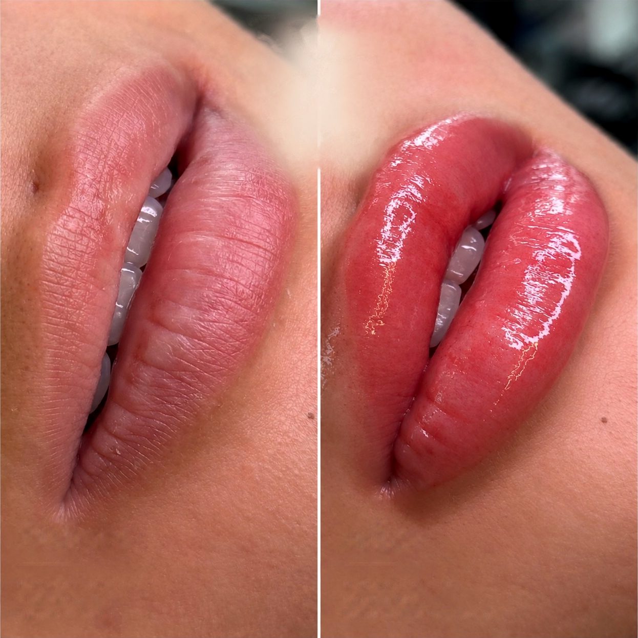 Before and after touch-of-colour lip blush: pale, dry lips on the left; glossy, vivid rosy-red lips on the right
