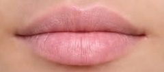 Healing stage 1, before: natural lips without pigment